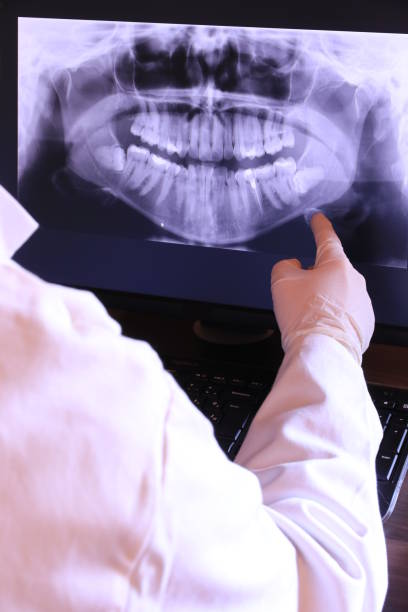 Best Emergency Dental Extractions in Morrisville, PA