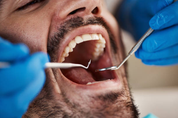 Best Emergency Dentist for Knocked-Out Tooth in Morrisville, PA